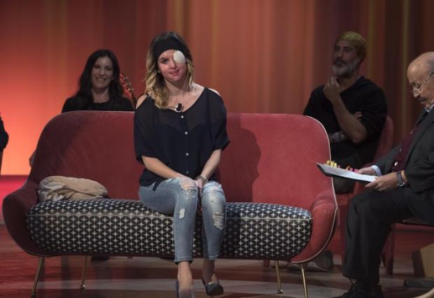 ex-finalista-miss-italia-sfregiata-con-acido-va-al-costanzo-show