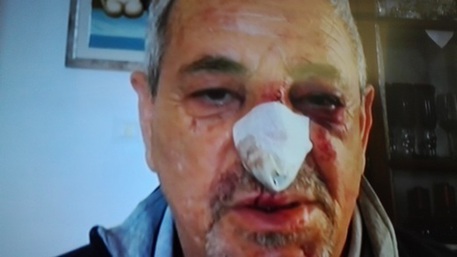 pestaggio-a-cagliari-vittima-and-quot-aggredito-su-commissione-and-quot