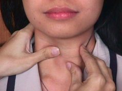 Sanità, campagna sensibilizzazione nelle scuole sulla carenza di iodio sanit-and-agrave-campagna-sensibilizzazione-nelle-scuole-sulla-carenza-di-iodio