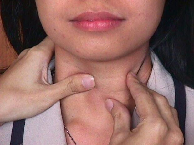 sanit-and-agrave-campagna-sensibilizzazione-nelle-scuole-sulla-carenza-di-iodio