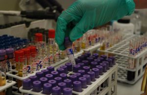 ebola-caso-sospetto-a-sassari-due-giorni-per-escludere-virus