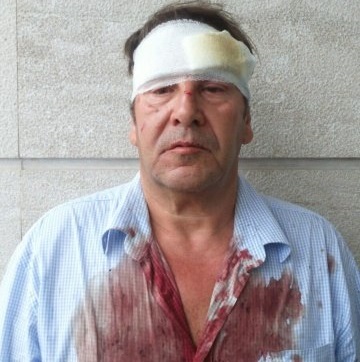 Calci calci-pugni-e-schiaffi-antonello-lai-e-cameraman-pestati-al-campo-nomadi