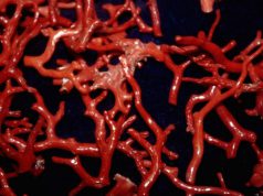 Corallo rosso ad Alghero, al via campagna tutela e promozione corallo-rosso-ad-alghero-al-via-campagna-tutela-e-promozione