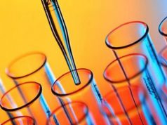 sparite-provette-dna-sardi-and-quot-pirastu-le-ho-spostate-io-and-quot