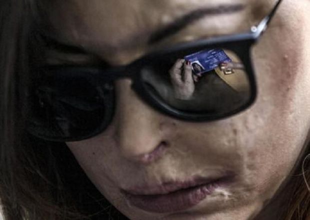 riminese-fregata-con-l-acido-dal-suo-ex