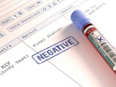 lila-cagliari-and-egrave-record-di-accessi-ai-test-rapidi-per-l-and-rsquo-hiv