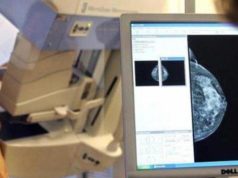 Tumori, Aou Sassari: “Da sabato più interventi in day surgery”