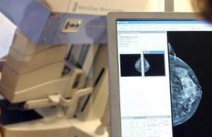 Tumore in Sardegna: crescono gli screening, ma ancora troppo alcol per il 21% dei cittadini