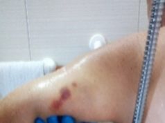 Casa di riposo degli orrori scoperta ad Oristano – ATTENZIONE: presenti immagini che potrebbero urtare la vostra sensibilità