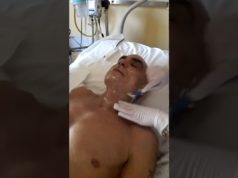 L’ironia del Massiccione dopo l’intervento: “Mi depilate? Ci tengo all’immagine”