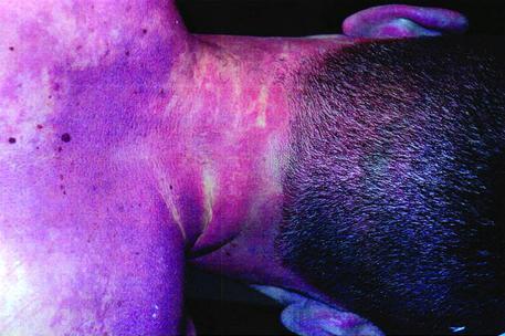 Ucciso in discoteca,familiari pubblicano su Fb foto autopsia