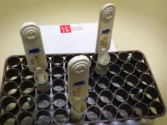 Hiv, a Cagliari si può fare il test rapido salivare a tarda sera