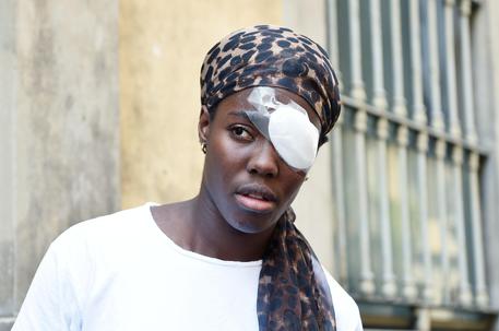 DAISY, CURA CON CORTISONE: MALAGO' 'EUROPEI A RISCHIO'