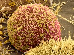 Secondo paziente libero da Aids con trapianto staminali