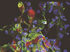 Dall’Italia un materiale-chiave contro le lesioni nervose