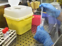 Coronavirus, positivo a Bonarcado. Il paziente è stato trasferito al Santissima Trinità